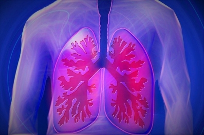 Najczęściej występujące choroby układu oddechowego